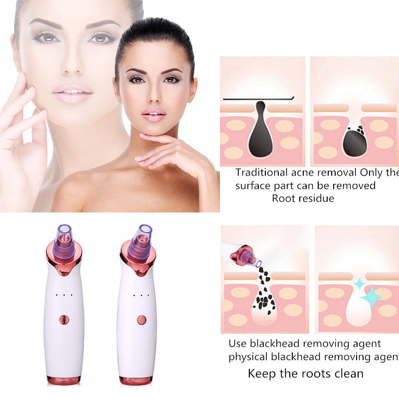 PorePerfect Blackhead Vacuum – Your Ultimate Skin-Clearing Companion!